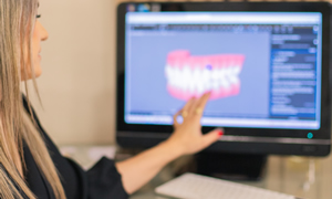 Implantes Dentários